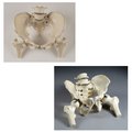 Denoyer-Geppert Anatomical Model, Male & Female Pelvis Set w/Femur Heads SV623